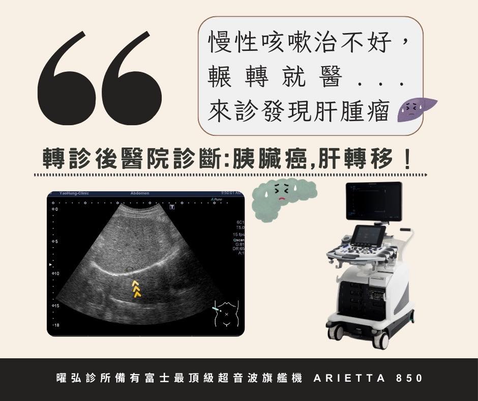 案例分享-慢性咳嗽治與腹部超音波檢查