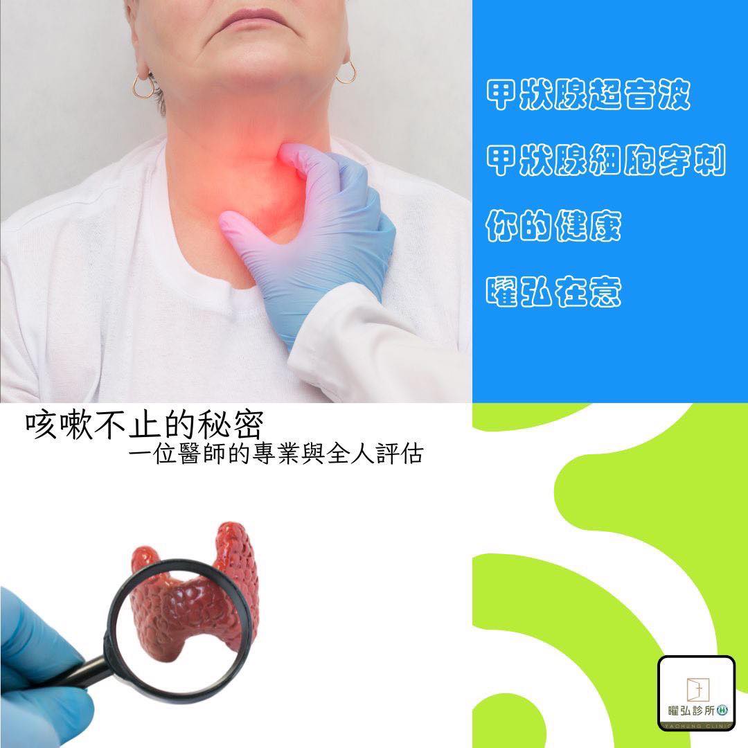 甲状腺超音波檢查