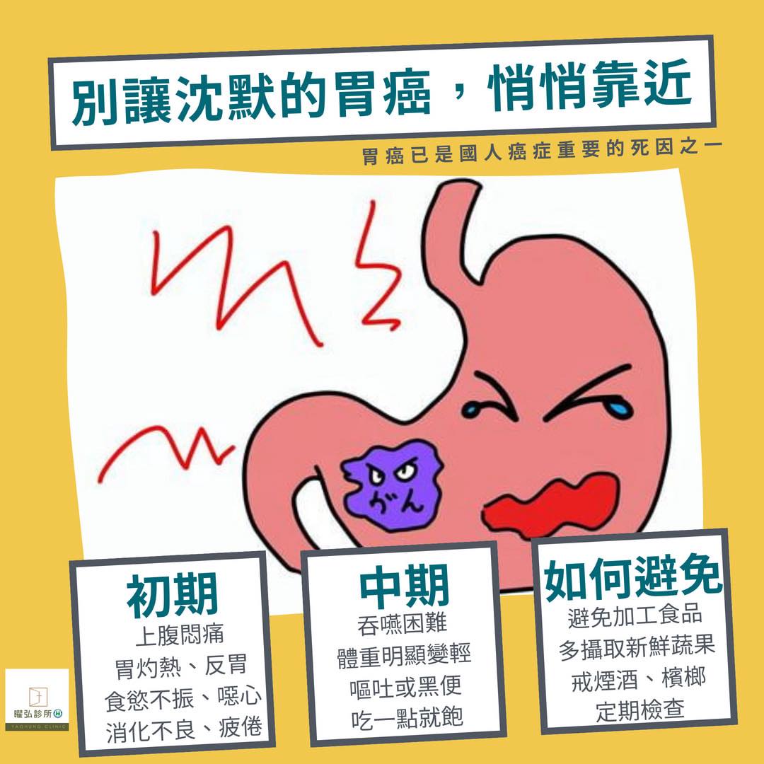 胃癌是全球常見的癌症之一