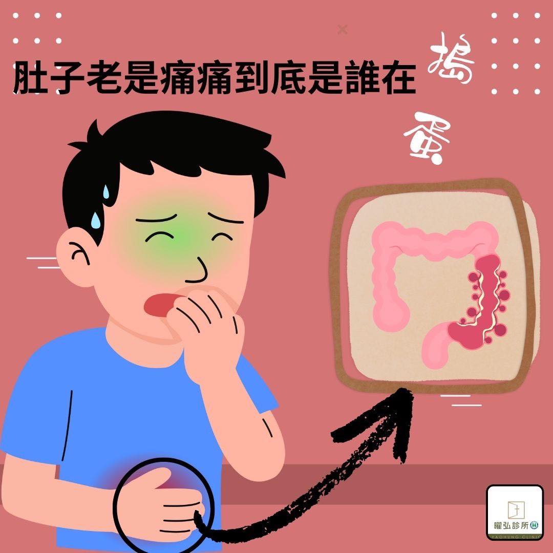 潰瘍性結腸炎