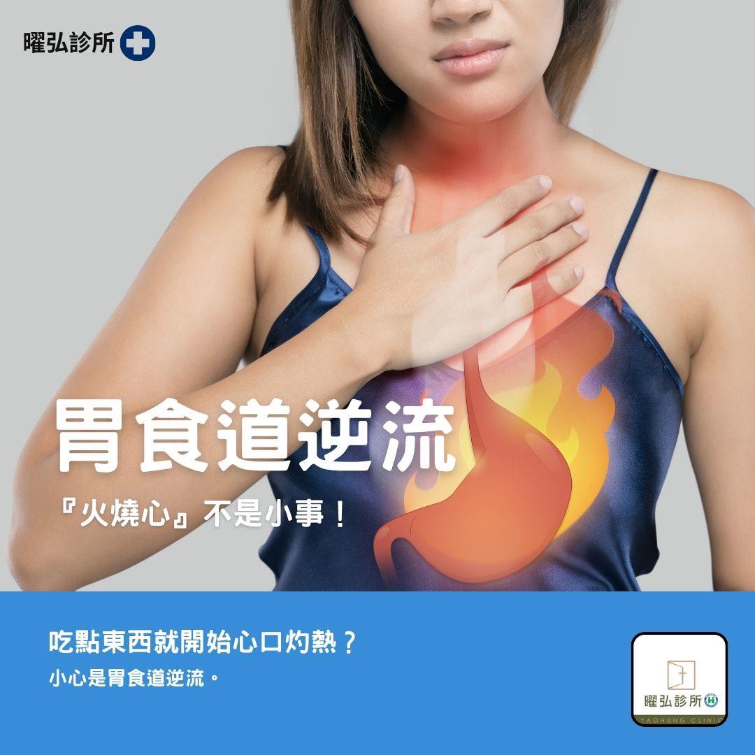 胃食道逆流
