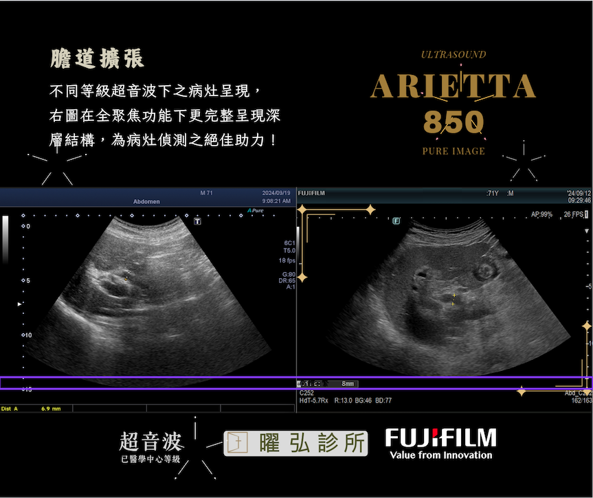 Equipment Xario 100 overview