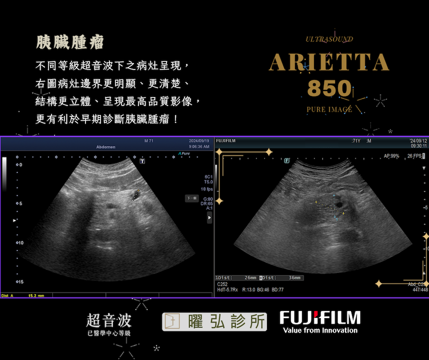 Equipment Xario 100 overview